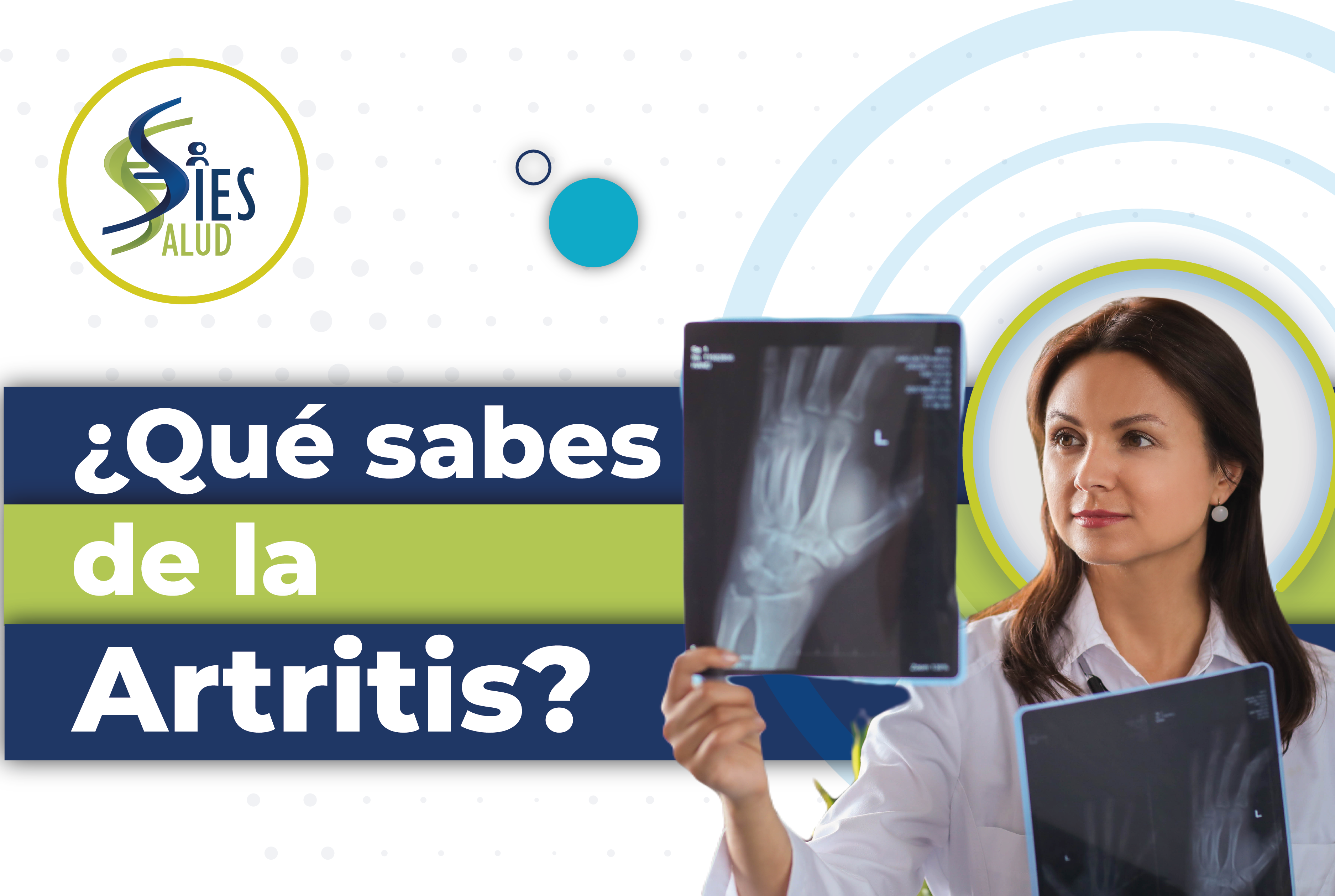Artritis reumatoide